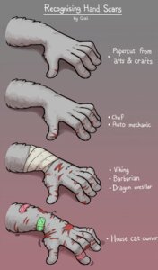 Rating: Questionable Score: 0 Tags: ambiguous_gender bandage blood bodily_fluids coal_(artist) digital_media_(artwork) disembodied_hand e621 english_text fur gore hand_shot hi_res humor outline scratch solo text the_truth unknown_species wounded User: bunchy7s