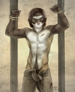 Rating: Questionable Score: 0 Tags: 2012 5_fingers anthro biped blood bodily_fluids bottomwear bound brown_hair captured claws clothed clothing conditional_dnp domestic_ferret e621 european_polecat fingers front_view green_eyes hair jarreth_(moodyferret) looking_at_viewer male mammal medieval moodyferret mustelid musteline navel pants pink_nose prisoner solo standing submissive submissive_male topless true_musteline weasel wounded User: bunchy7s Rating: Questionable Score: 0 Tags: 2012 5_fingers anthro biped blood bodily_fluids bottomwear bound brown_hair captured claws clothed clothing conditional_dnp domestic_ferret e621 european_polecat fingers front_view green_eyes hair jarreth_(moodyferret) looking_at_viewer male mammal medieval moodyferret mustelid musteline navel pants pink_nose prisoner solo standing submissive submissive_male topless true_musteline weasel wounded User: bunchy7s