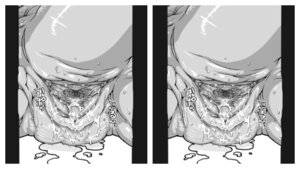 Rating: Explicit Score: 0 Tags: 16:9 1girls 3d ambiguous_species basilisk bodily_fluids cloaca cropped cross_eye_stereogram e621 edit edited female female_only genital_fluids genital_shot genitals greyscale japanese_text monochrome monster nezumi nezumi_(artist) pussy pussy_juice rear_view reptile rule34 scales side_by_side_stereogram solo stereogram text translation_request vaginal_fluids vulva vulva_shot wet widescreen User: bunchy7s Rating: Explicit Score: 0 Tags: 16:9 1girls 3d ambiguous_species basilisk bodily_fluids cloaca cropped cross_eye_stereogram e621 edit edited female female_only genital_fluids genital_shot genitals greyscale japanese_text monochrome monster nezumi nezumi_(artist) pussy pussy_juice rear_view reptile rule34 scales side_by_side_stereogram solo stereogram text translation_request vaginal_fluids vulva vulva_shot wet widescreen User: bunchy7s