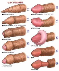 Rating: Explicit Score: 0 Tags: 2000s artist_request circumcised diagram foreskin foreskin_folds foreskin_overhang foreskin_pull fully_retracted_foreskin glans japanese_text male partially_retracted_foreskin penis retracted_foreskin rule34 source_request tagme tight_foreskin translation_request uncensored uncircumcised uncircumcised_penis unretracted_foreskin unusual_anatomy unusual_genitalia unusual_penis what User: bunchy7s Rating: Explicit Score: 0 Tags: 2000s artist_request circumcised diagram foreskin foreskin_folds foreskin_overhang foreskin_pull fully_retracted_foreskin glans japanese_text male partially_retracted_foreskin penis retracted_foreskin rule34 source_request tagme tight_foreskin translation_request uncensored uncircumcised uncircumcised_penis unretracted_foreskin unusual_anatomy unusual_genitalia unusual_penis what User: bunchy7s